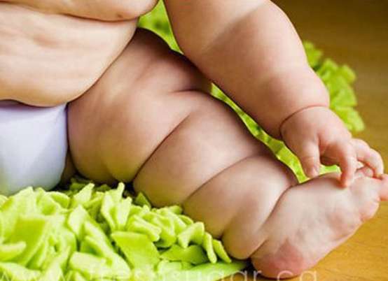Obesidade infantil