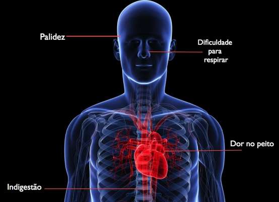 Sintomas do infarto